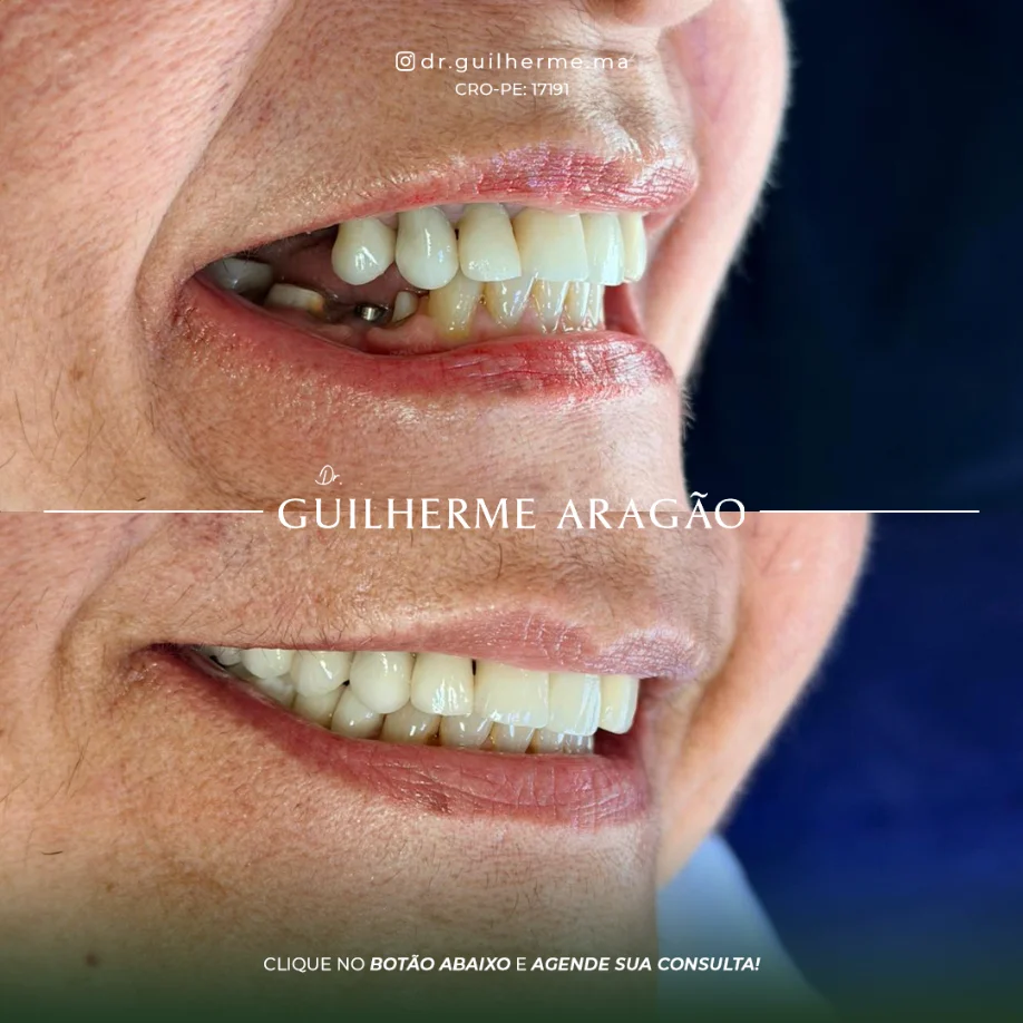 Caso em destaque 1 - antes e depois