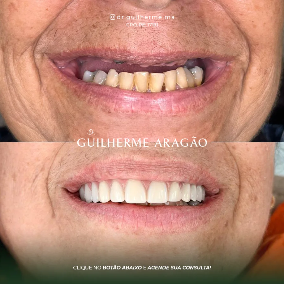 Caso em destaque 2 - antes e depois