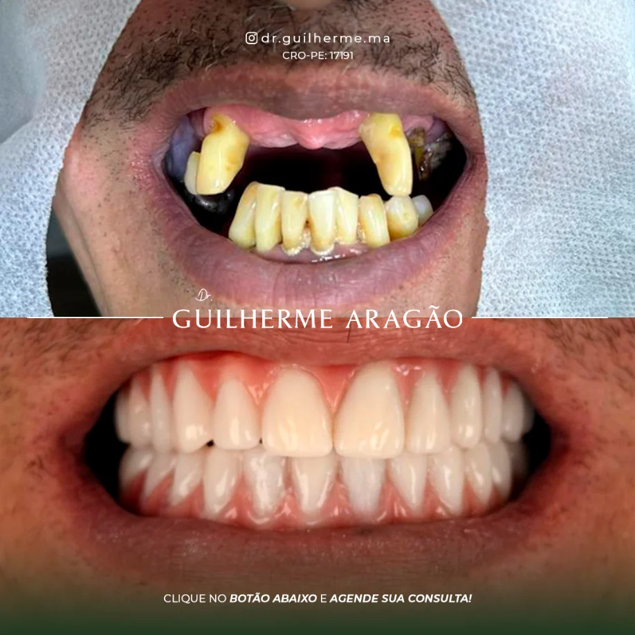 Caso em destaque 3 - antes e depois