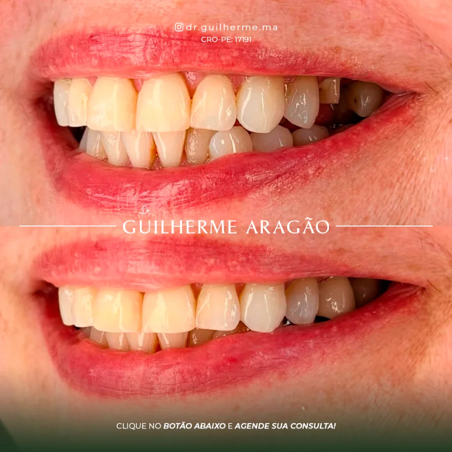 Caso em destaque 5 - antes e depois